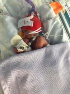 Baby Isaac in NICU