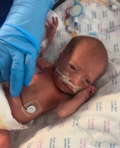 Baby Lucie in NICU